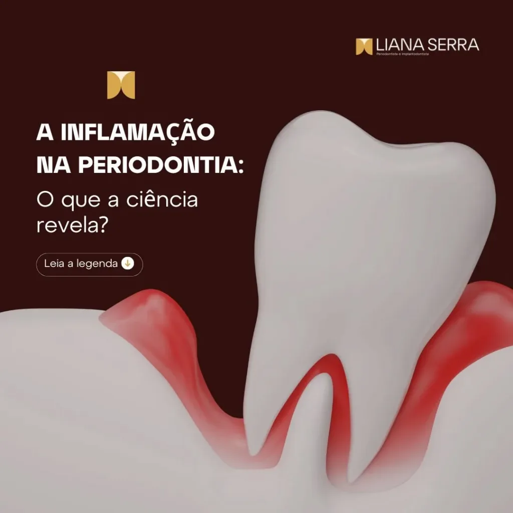 Inflamação Crônica: O Vilão da Saúde Periodontal