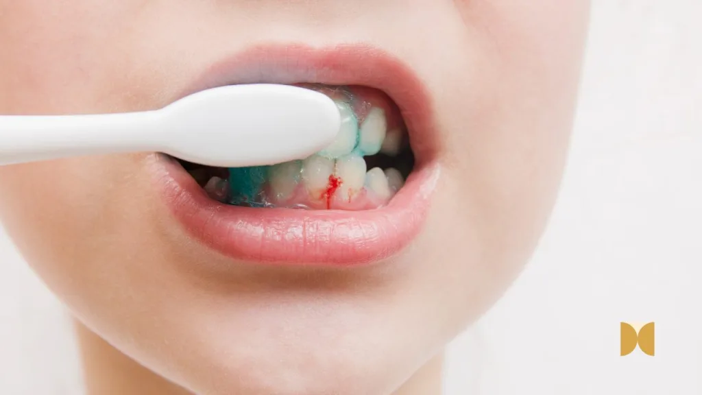 A Importância da saúde gengival para um sorriso saudável
