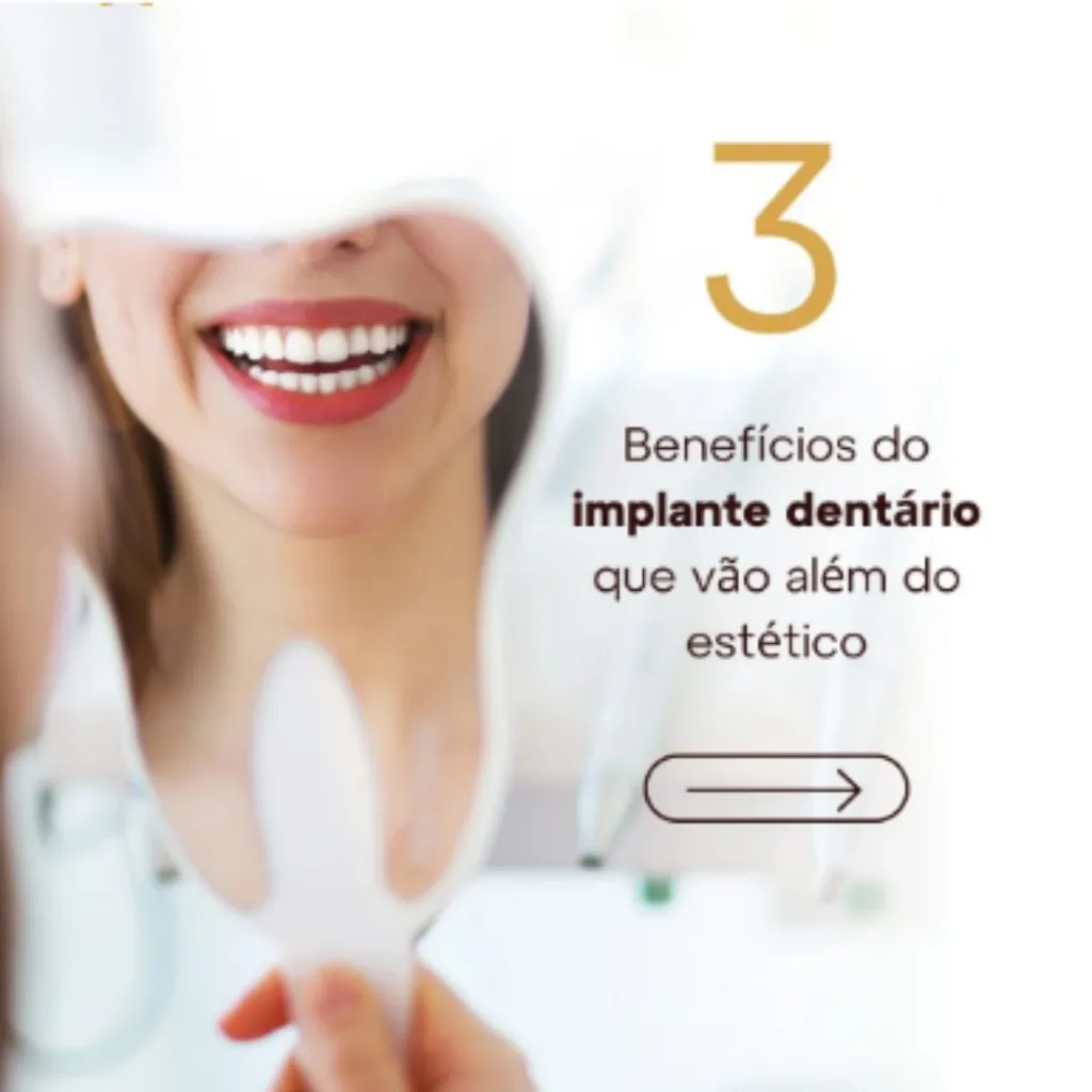 Implantes