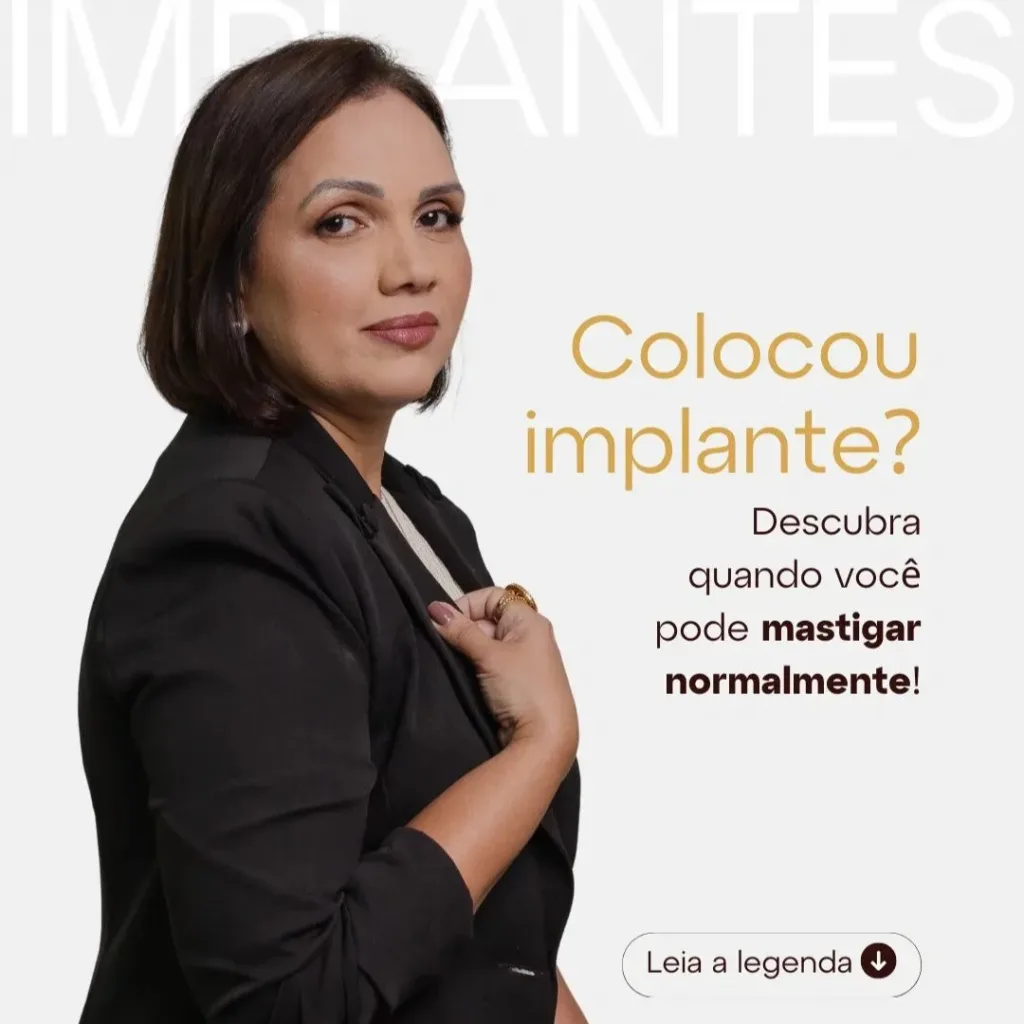 Seu Implante Dentário Está Pronto para Mastigar