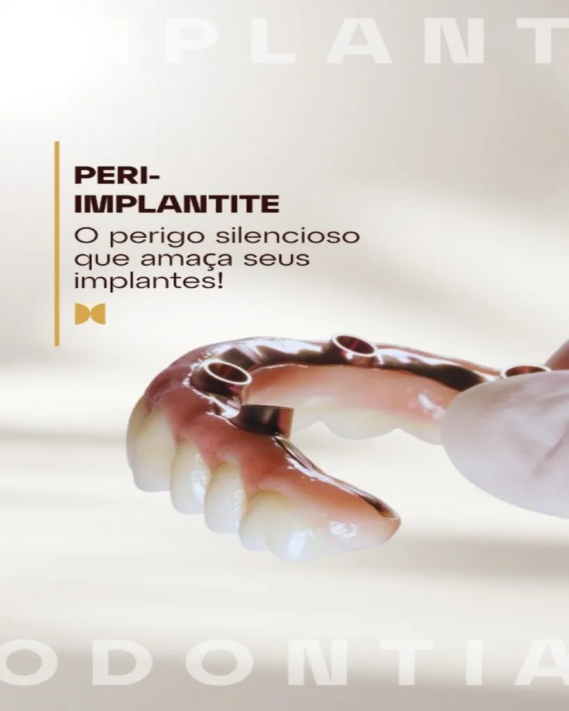 peri-implantite