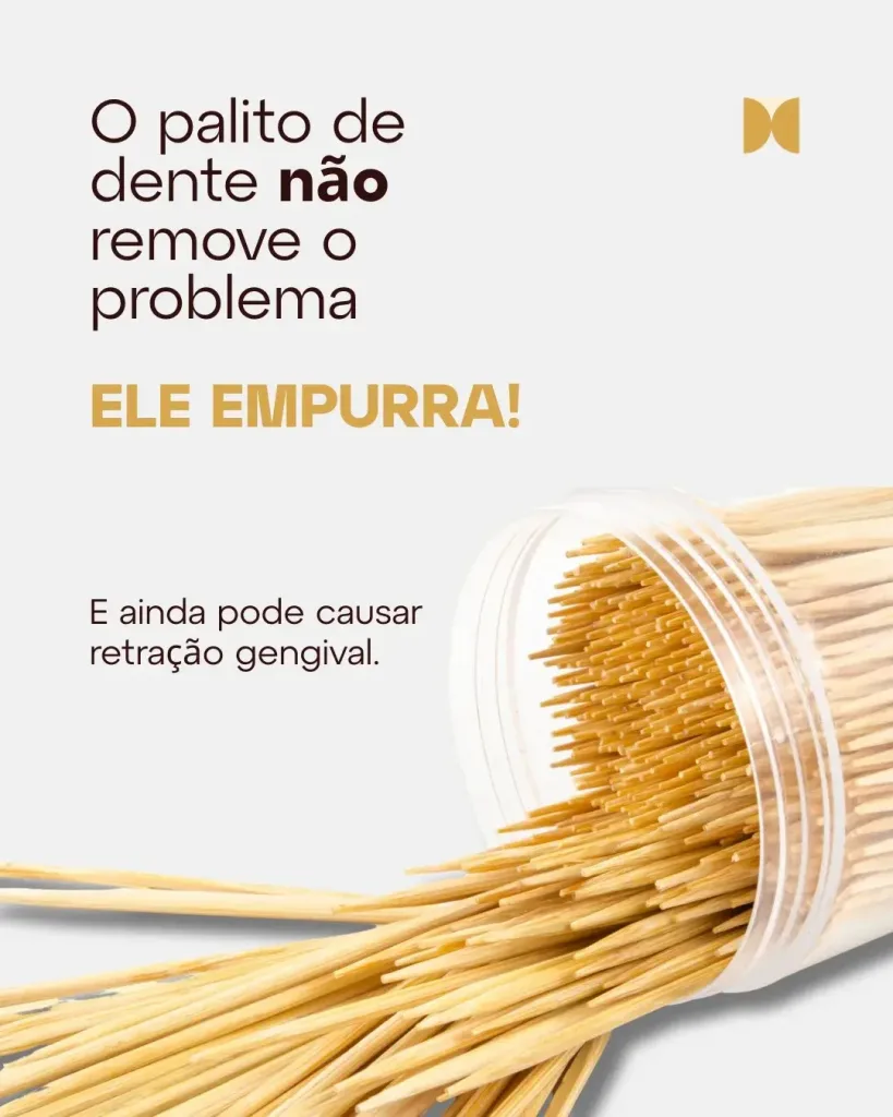 Palito de Dente Causa Retração Gengival? Descubra o Perigo Oculto que Poucos Sabem