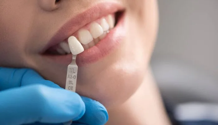 peri-implantite