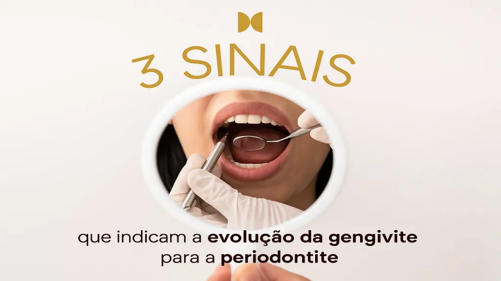 3 SINAIS de que a Gengivite Pode Estar Evoluindo para Periodontite – Fique em Alerta!